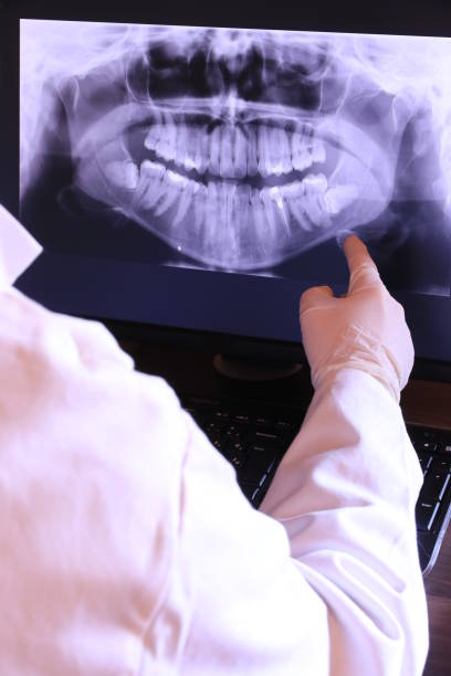 Best Emergency Dentist for Lost Fillings or Crowns in Mapleton, UT