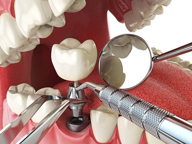 Best Emergency Cosmetic Dentistry in Mapleton, UT
